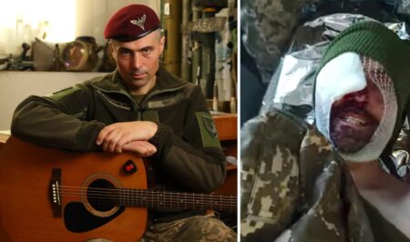 Відомий український актор Дмитро Лінартович поранений у Соледарі