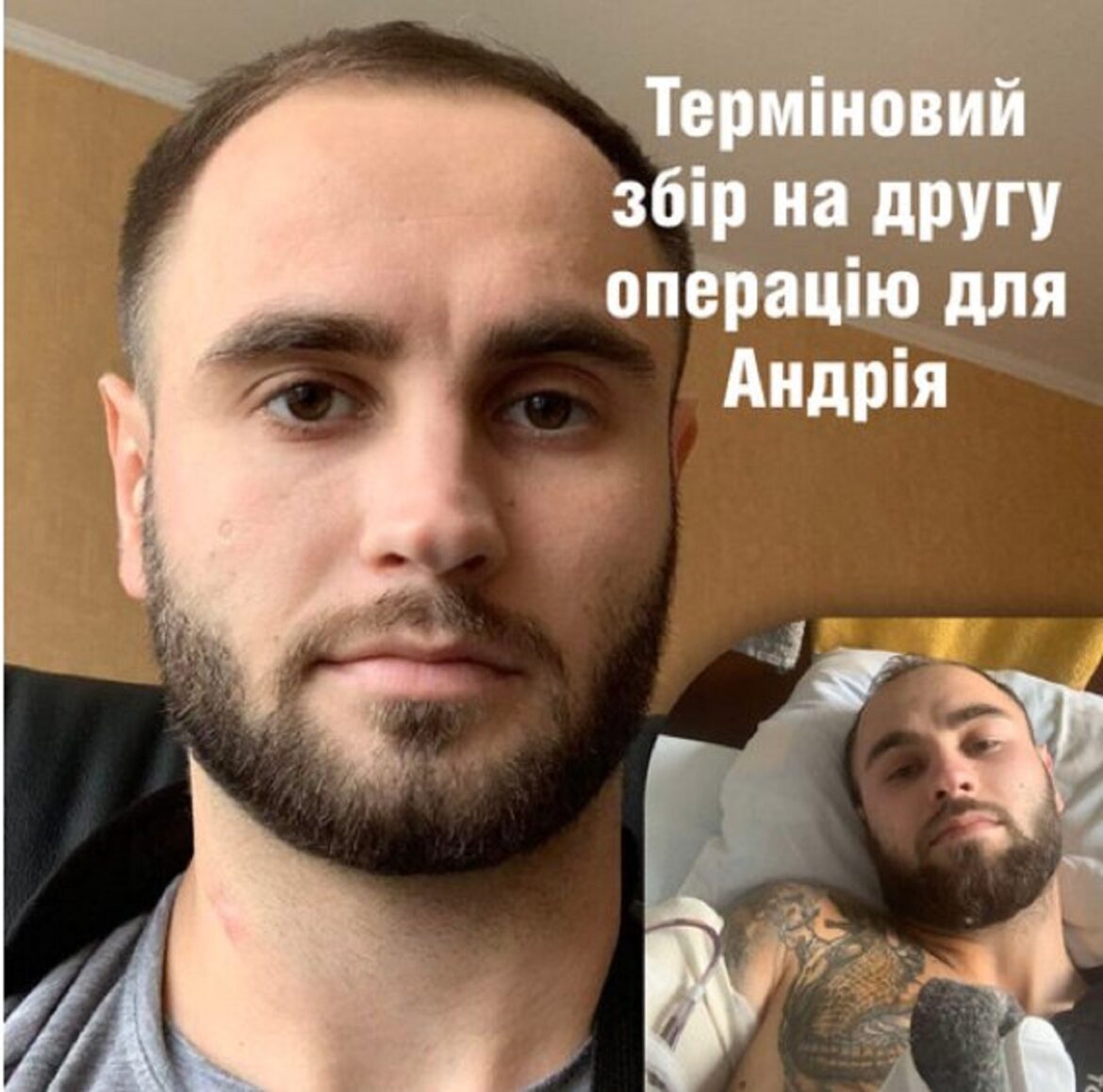 БФ «Здоров’я українського народу»: долучайся до національної програми #ВрятуйКінцівку